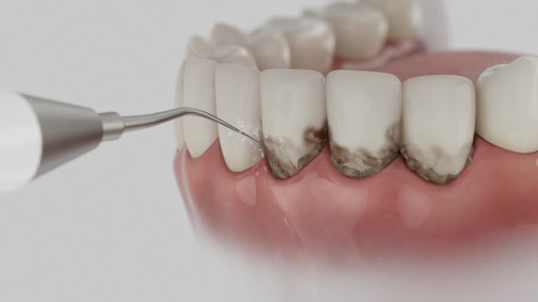 Trusted Teeth Cleaning And Checkup service in Middletown, KY - Dentist Open Now